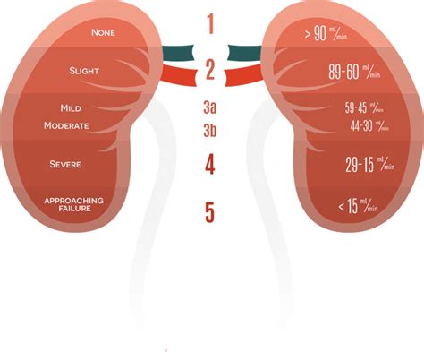 The Kidney Failure Risk Equation