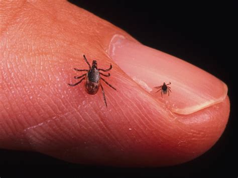 Infectious disease consultant warns of almost 2,000 cases of Lyme