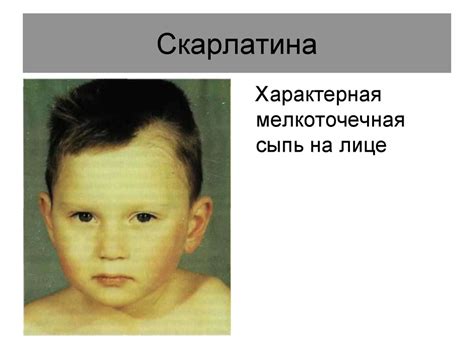 Фото-презентация по детским инфекциям - online presentation