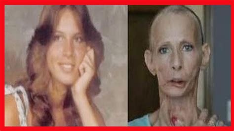 Fotos De Pessoas Que Pararam De Fumar Antes E Depois - Pessoas Antes E Depois De Fumar Os Famosos Que Pararam De Fumar E Como