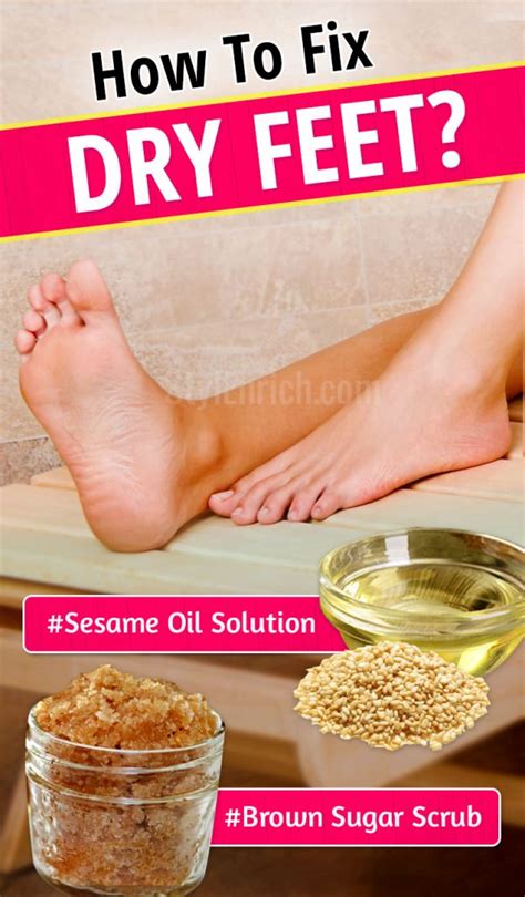 How to Fix Dry Feet : Home-Based Remedies To Cure Dry Feet