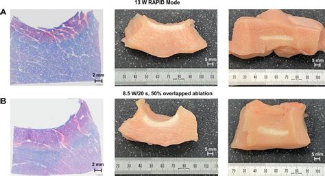examples  pathological  gross evaluation  linear lesions