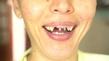 Smiling Toothless Boy On White Back Free Stock Photo - Public Domain