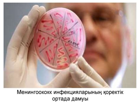 Менингококкты инфекция - презентация онлайн