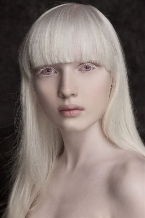 White Albino