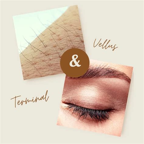 Vellus Hair Vs. Terminal Hair: What Are The Differences?