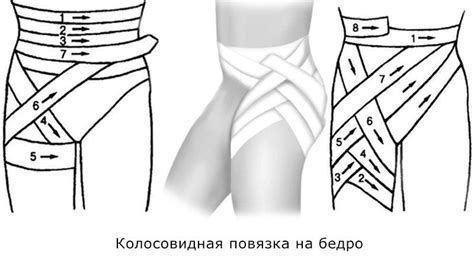 Эластичные бинты на ноги перед и после операции: как правильно ...