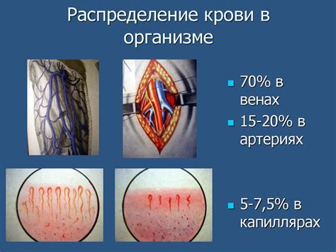Кровотечение, кровопотеря - презентация онлайн