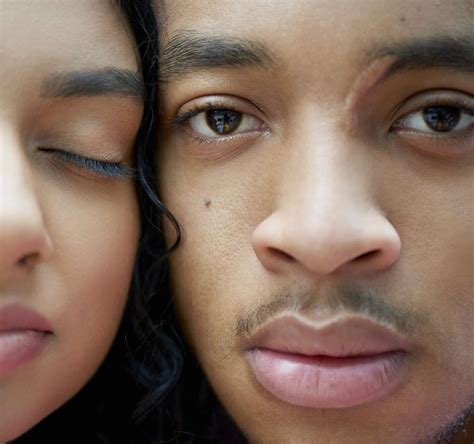 What is a Keloid: Causes, Treatment, & Removal