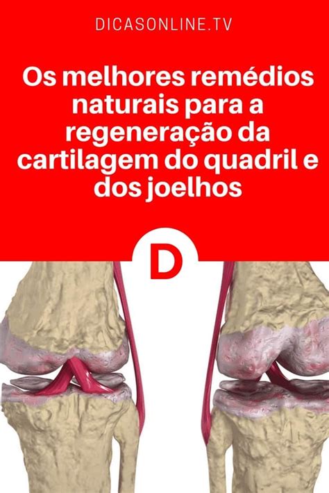 Remédio Caseiro Para Desinflamar O Joelho - Cartilagem joelho | Os melhores remédios naturais para a regeneração da ...