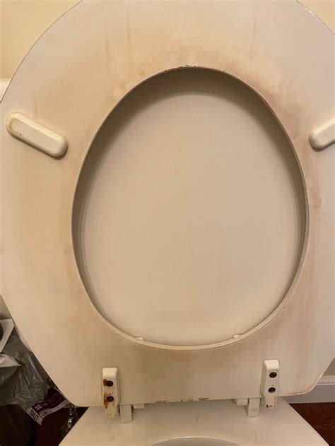 How to Clean a Urine Stained Toilet Seat: Quick & Easy!