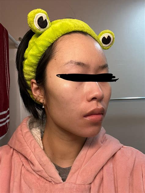 how to apply tretinoin 6