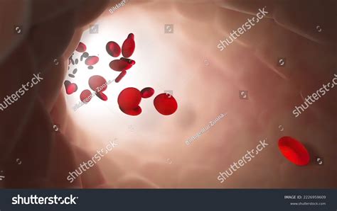 Bacteria Attack Digestive System Stock Illustration 2226959609 ...