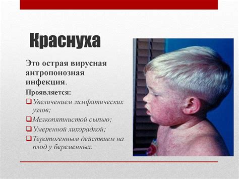 Краснуха. Этиология - презентация онлайн