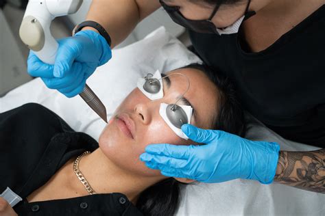 Vegas Laser Peel | Vancouver Laser & Skin Care Centre