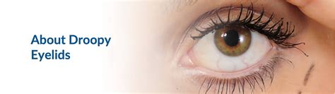 Droopy Eyelid Treatment Detroit, MI | Shanbom Eye Specialist