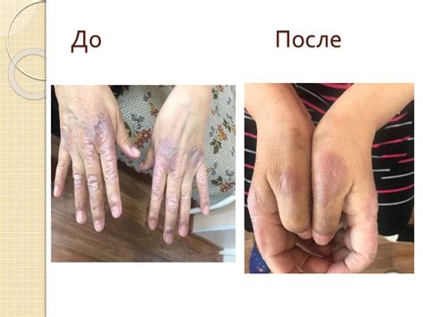 Пациенты с аллергией - презентация онлайн