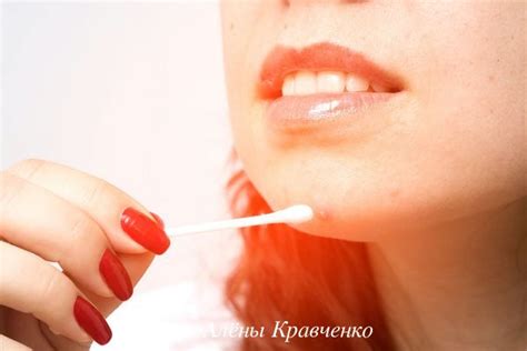 Салициловая кислота от прыщей - эффективные рецепты