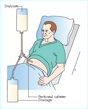 Peritoneal Dialysis | Nurse Key