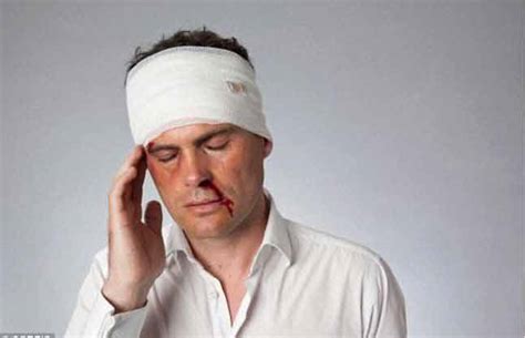 Top 3 Natural Homeopathic Remedies for Treating Head Injuries ...