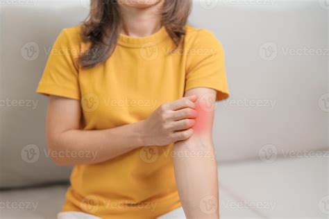 woman itching and scratching itchy arm. Sensitive Skin Allergic