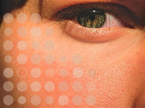 Acne: The long and the short of it. — Entière Dermatology