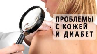 Проблемы с кожей при сахарном диабете - YouTube