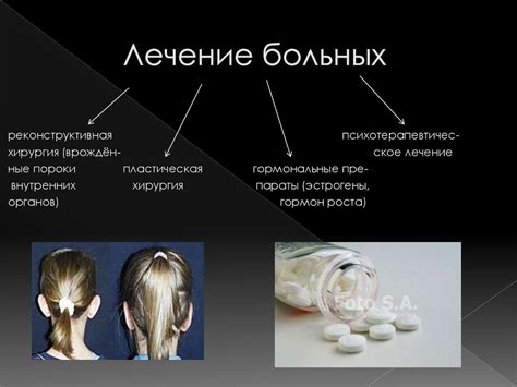 Синдром Шерешевского - Тернера - презентация онлайн