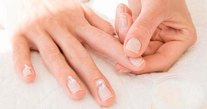 Пъпки по проявите на ръцете върху лактите, пръстите и дланите