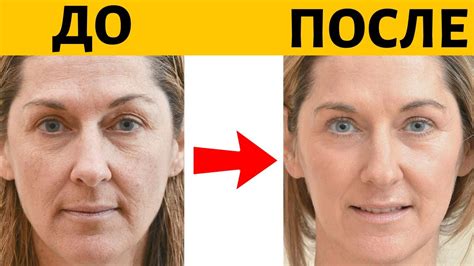 5 минут в день! 3 ПРОСТЫХ омолаживающих упражнения для лица - YouTube