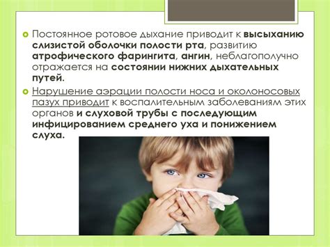 Гипертрофия небных миндалин. Гипертрофия носоглоточной миндалины ...