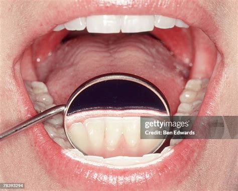 bottom teeth stock  high res pictures  images getty images