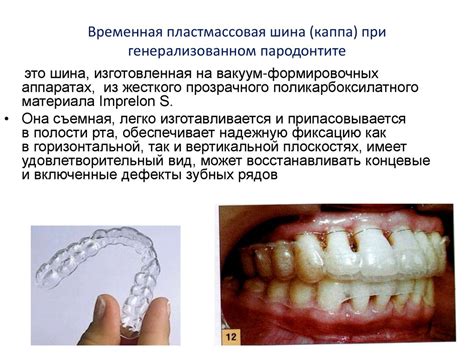 Основные принципы лечения локализованного и генерализованного ...