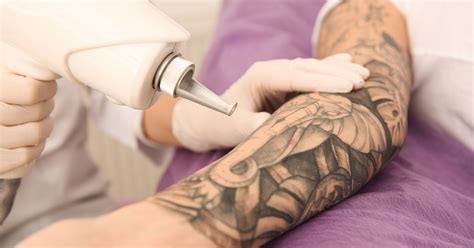 tattoo removal treatment  johor bahru