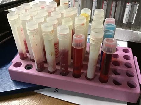 plastic vacutainer holder   vacutainers