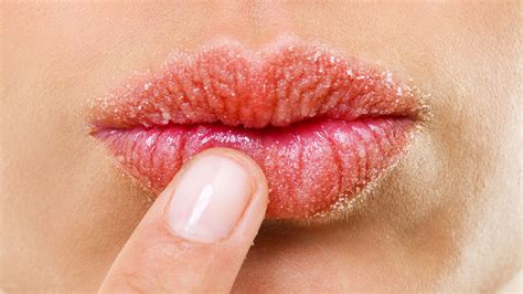 Dry Lips: The Causes, Treatments and Products To Try Now | Glamour UK