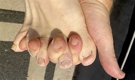 Feets Don’t Fail Me Now – Always Merry and Bright