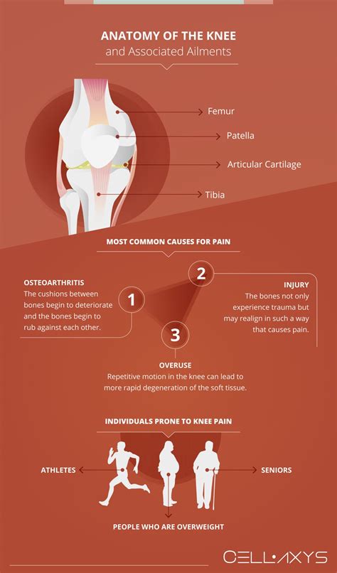 How Long Does Pain Last After Knee Replacement Surgery? - Cellaxys