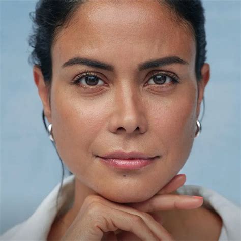 top juvederm treatment  ontario canada
