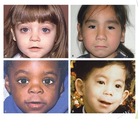 Identify the Syndrome - MEDizzy