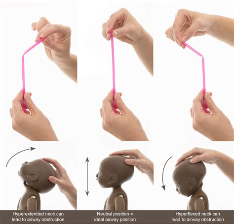 Positional Restraint Asphyxia 3