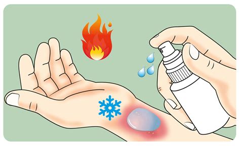 Burns - The A to Z of rapid treatment - Global