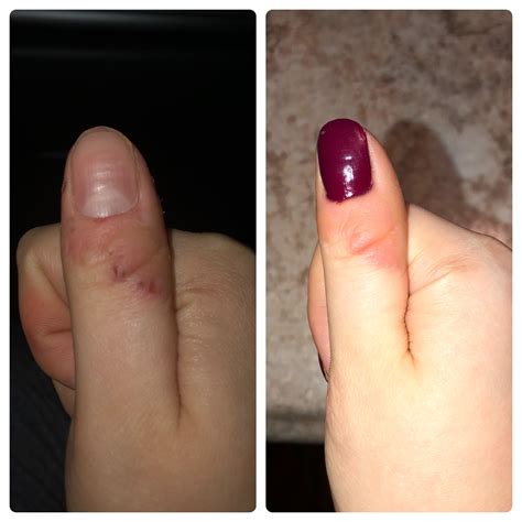 Discoloration help? Explanation in comments : r/calmhands