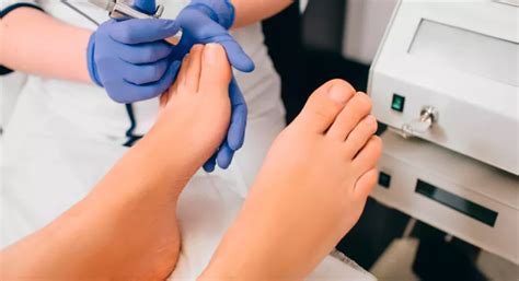 Tratamiento y prevención de la onicomicosis - Salud al día