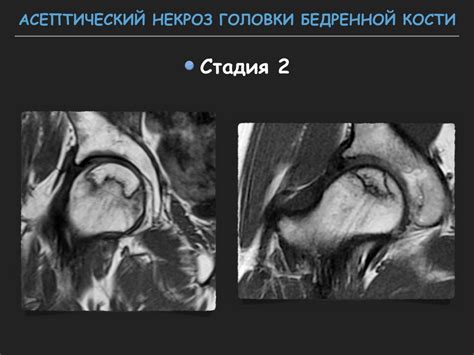 Визуализация тазобедренного сустава