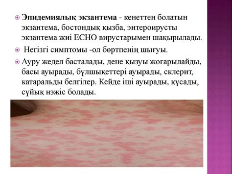 Энтеровирусты инфекция - презентация онлайн