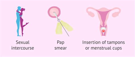 how to know if i have vaginismus