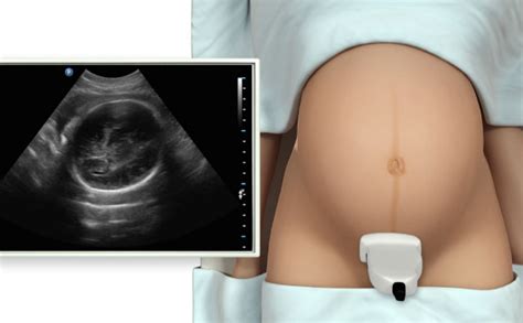 Ultrasound Assessment of Fetal Growth - SIMTICS