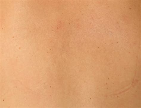 390+ Sweaty Skin Texture Stock Photos, Pictures & Royalty-Free Images ...