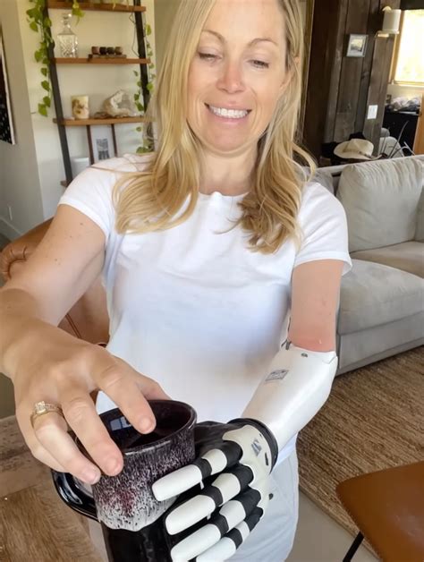 Sarah Herron Reveals How Her Prosthetic Arm Works in New Video: ‘It’s